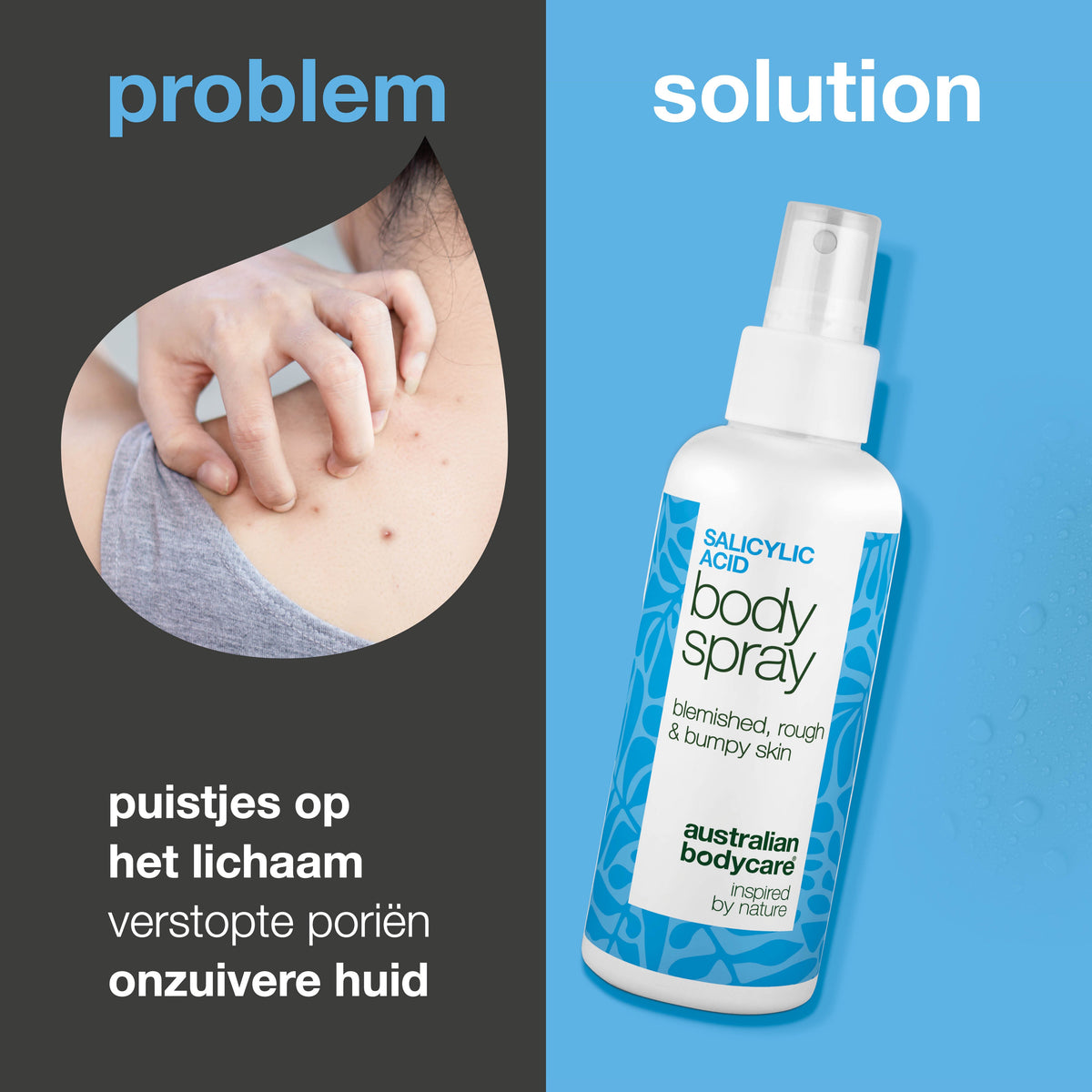 Salicylzuur spray tegen puistjes en verstopte poriën — Salicylzuur spray tegen puistjes en onzuiverheden. Met salicylzuur en glycolzuur voor diepe reiniging en gladde huid.