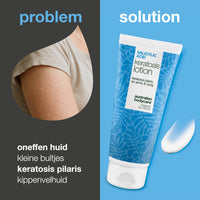 Body lotion bij keratosis pilaris en ruwe, bobbelige huid — Body lotion voor keratosis pilaris en droge huid. Verzacht met salicylzuur, niacinamide en zink.