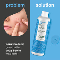 Salicylzuur-toner voor puistjes en vergrote poriën — Salicylzuur-exfoliant reinigt poriën, vermindert puistjes en verfijnt de huidstructuur. Perfect voor de dagelijkse verzorging.
