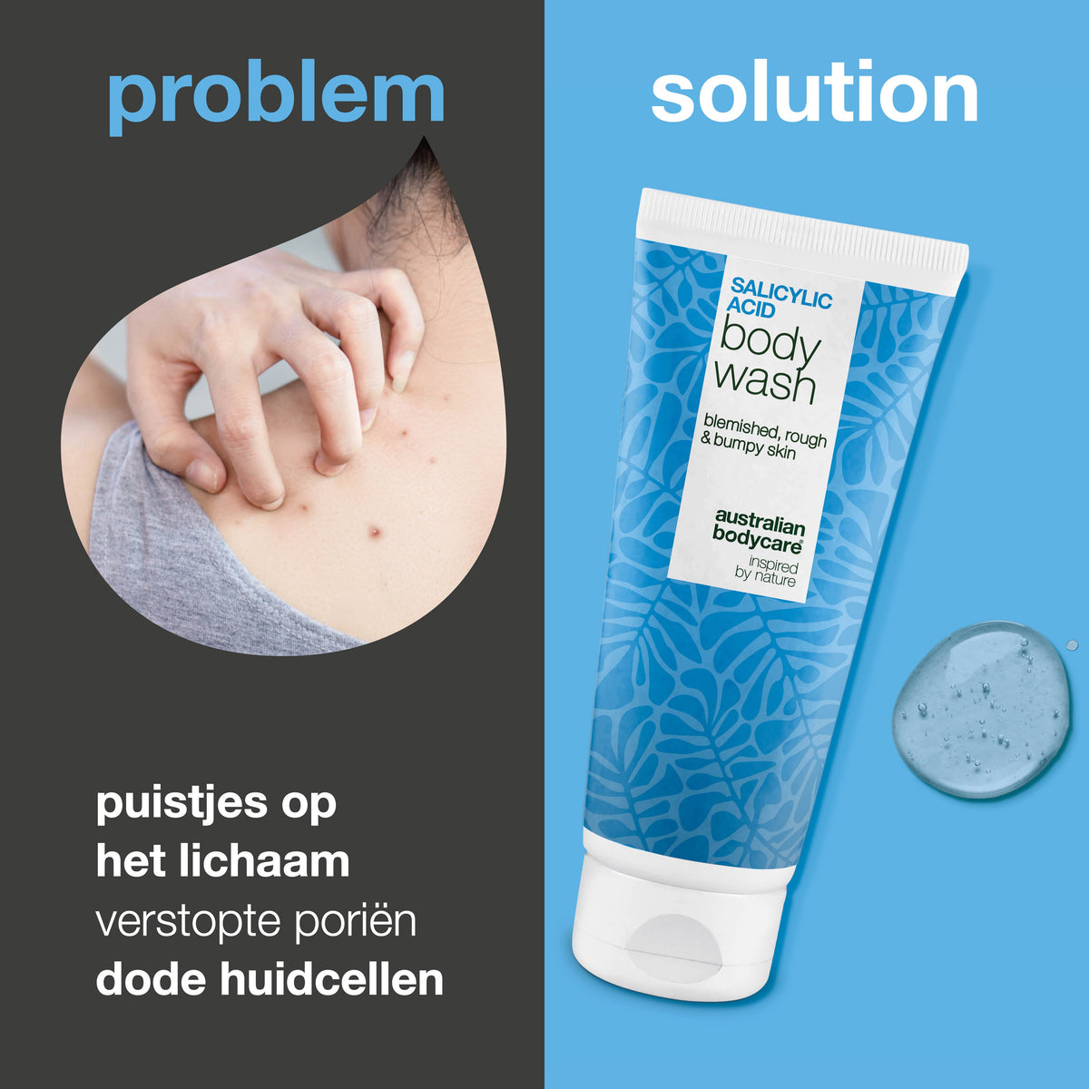 Salicylzuur Douchegel voor een onzuivere rug en billen — Salicylzuur Body Wash tegen puistjes en poriën. Met salicylzuur, niacinamide, zink PCA en hydraterende glycerine.