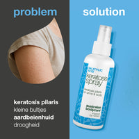 Keratosis pilaris spray tegen ruwe huid en bultjes — Keratosis pilaris spray vermindert ruwe bultjes en maakt de huid glad. Bevat salicylzuur voor diepe exfoliatie.