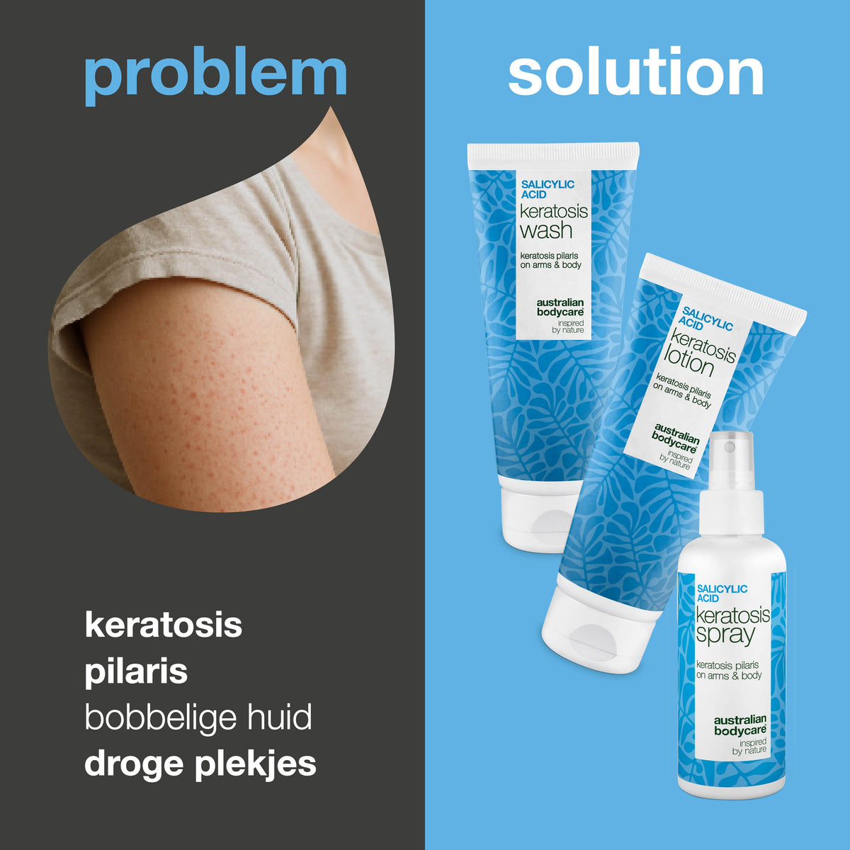 Pakket tegen Keratosis Pilaris – Maakt ruwe huid glad — Verzorgingsset voor kippenvelhuid/aardbeienhuid vermindert droge, oneffen huid. Helpt bij kleine rode bultjes op huid voor een egaal resultaat.